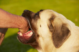 dog bite lawyer